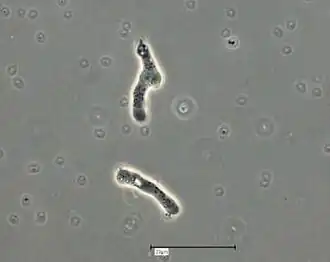 Trophozoites, morphologie monopodiale typique.Saline amibienne. Contraste de phase.Barre (échelle) : 20&nbsp;µm.