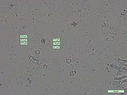  Photographie au microscope de petites sphères mesurées dans leur longueur et leur largeur