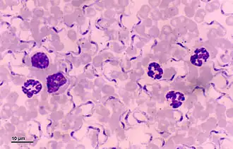 Description de l'image Trypanosoma (248 09) Trypanosoma equiperdum.jpg.