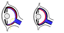 coupes anatomiques des yeux.