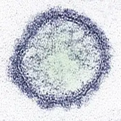 Description de l'image Virus de Schmallenger.jpg.