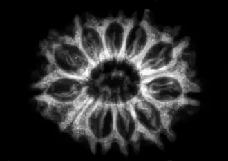 Radiographie d'Elaeocarpus ganitrus révélant 10 locules porteuses de graines à l'intérieur&nbsp;