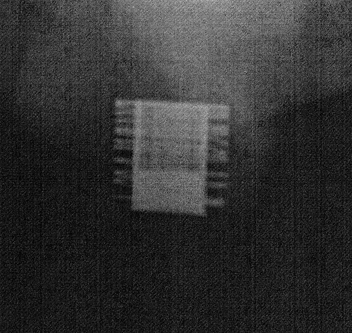 Radiographie d'un ZSI 375 implanté. Le dispositif est activé: le ressort est au niveau du sommet du cylindre. Le patient est continent.