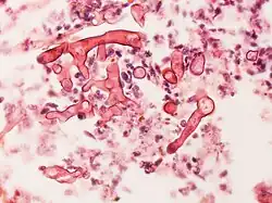 Hyphes « en rubans », avec branches à 90°.