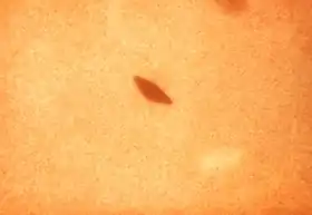 Description de l'image Streptococcus_salivarius.tif.